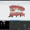 림플란트치과의원 이미지