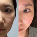 용담로117번길 | 송도슈퍼젝션 인천 연수역 피부관리 잘하는 뷰에나에스테틱 토탈뷰티