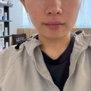 강남피부과의원 | 강남역 피부과 온다리프팅 솔직후기 제로피부과의원