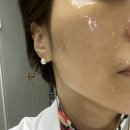 삼성동 인셀덤 무료체험: 인셀덤문라이트