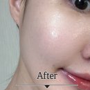 세멘시트 효과 사용법 부작용 세멘잘라이트 크림 내돈내산 솔직후기
