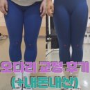창원가음정피티ㅣ오다리 교정 후기 공유(+내돈내산)
