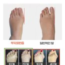 바른의료기 이미지