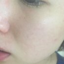 구암동592 | 대전왁싱 : 슈가슈가링 스킨맘'S 대전점 페이스왁싱 후기 / 유성페이스왁싱, 유성브라질리언왁싱