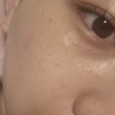 만석로 | 수원 [벨라끄에스테틱] 색소침착 관리 찐강추 후기