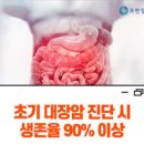 대장암 전조증상 골든타임 지키는 것이 중요해요 이미지