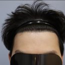 압구정모비앙의원