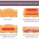 디피엘 이미지