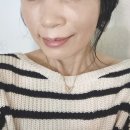 (주)새앰 샘사우나 | 마곡피부과 티타늄리프팅 2주차 후기｜강서구 피부과 리프팅 효과 비교