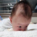 아기 사경 / 사두 치료 기록. 사경, 사두란? 사경 극복 보라매병원 후기 :)