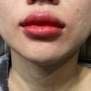 김해 장유 율하 입술 잘하는 곳 더케이토탈뷰티