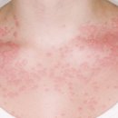 조생한의원 이미지