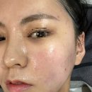 씨유 울산달동원룸점 | [울산 남구] 속건조 관리/ 여드름 피부 관리 후기 :) 유드림에스테틱