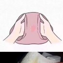 참조은산부인과 이미지