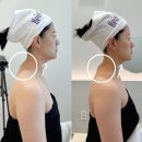 윤곽관리 10회차 최종 후기 케이엠에스테틱 민서 선생님 관리 내돈내산