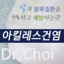 아킬레스