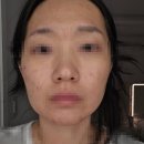 메디인 | (내돈내산 광고X) 실제후기 메디인랩 A3 앰플 구매 사용 후기