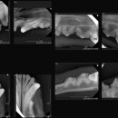 서현 덴탈 이미지