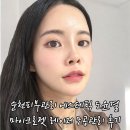 왕지로 | 순천피부관리 에스테틱 도윤결 마이크로젯 레이저 후기