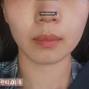 더고운에스테틱 - 포항시 북구 | 대전 "고운빛깔에스테틱" 웨딩 관리 후기