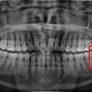 서울미라클치과의원 이미지
