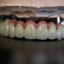 디에이엘치과기공소 | 금천구 가산동 치과 디에이엘치과기공소 진료시간 접근성 이용후기
