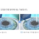 조은눈안과의원 이미지