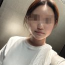 동그라미화장품 - 동대문구 답십리로56길 126 | 부산 울쎄라 피프라임 300샷 후기 덕천동 피부과 마취 통증 붓기