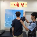 오십견의 원인과 비수술적 치료 | 남양주 오십견치료병원 추천! 어깨 굳음 해결하는 비수술 치료 후기