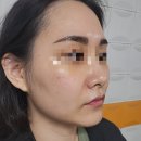 다올뷰티 | 동탄피부관리 자극없는 프리미엄케어 다올뷰티 후기