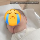 [출산 후] 봄빛병원 -> 서울 삼성병원 전원 후기