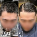 하여 | 1-2cm길이,남자 짧은머리 쌍가마 모류교정 하여 남자 포마드펌 후기