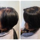 노원-현장-1379 | 의정부가발 어머니 생신선물 감동후기,노원가발 자연스러운 여성부분가발.