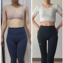 라니멍 | 365mc람스 통증, 멍, 붓기 실제 후기가 궁금하다면 (+가격)