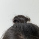 반디헤어 - 남동구 | 헤어라인 한 달 후기, 반디 앰플 쓰고 생긴 변화들