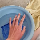 광개토병원 | [임신30주] 대구 임산부 화상 치료후기 (feat. 광개토병원)