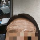 권비뇨기과의원 | 대구광역시 동구 신암4동 대상포진 전문병원 추천 | 무료접종 | 예방접종