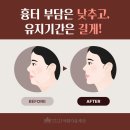 플레인의원 이미지