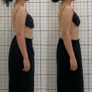 뷰티바이니 | 검단체형관리 비대칭 승모근&어깨 신부관리 추천 뷰티바이니