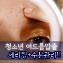 청소년 여드름 집중 관리! 세라링과 수분관리의 놀라운 효과🌟 &lt;인천청소년여드름압출전문관리&gt;