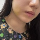 마로니에 | [마로니에치과] 사랑니 발치 후기....