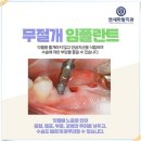 박외과의원 | [무절개 임플란트 후기] 11년의 세월간 오래 사용하는 임플란트의 비결