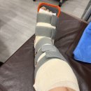 범어퍼스트정형외과의원 | 신도림퍼스트정형외과의원 후기