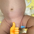 그대를 읽다 | 생후2개월 신생아탈장수술 소아탈장수술 담소유 내돈내산 솔직후기
