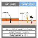 링원 이미지