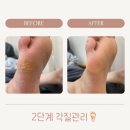 네일트위