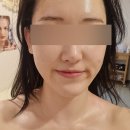 윤정 에스테틱 - 중구 | 마두역 탄력재생관리 윤정에스테틱 PDRN 연어테라피 후기