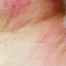 누베베한의원 이미지