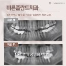 서울바른정치과의원 이미지