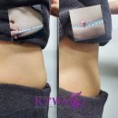 궁테라피 이미지